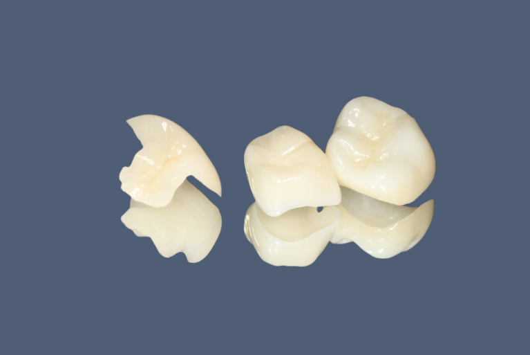 ジルコニアセラミック