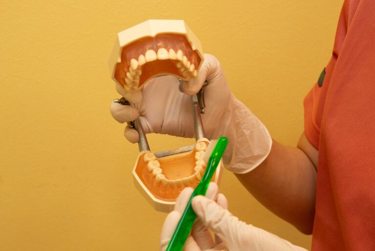 歯の予防について